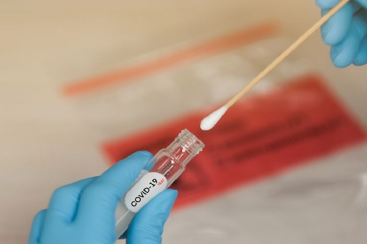 RS dan Lab Pemeriksa COVID-19 Wajib Ikuti Ketentuan Baru Tarif Tes PCR